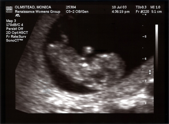 Baby Mojo